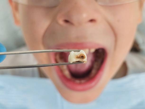 Dentist for Dental Trauma in NJ